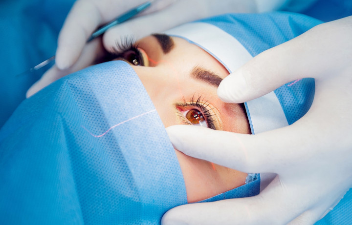 Catarata, recomendações do Médico para retardar os efeitos 