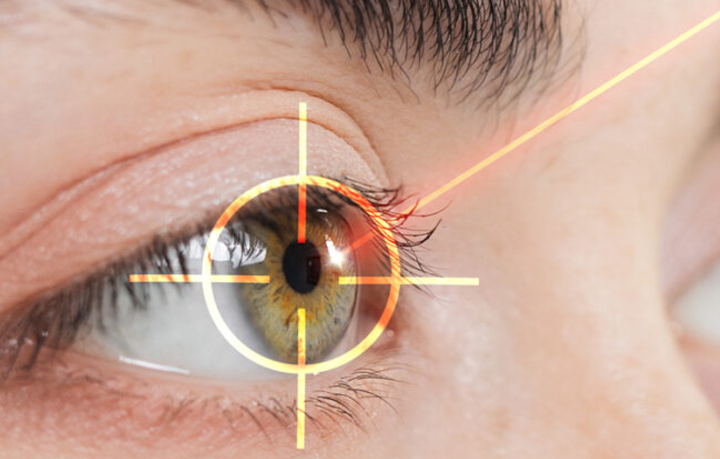 Aquecimento global já responde por 20% dos casos de catarata Aquecimento global já responde por 20% dos casos de catarata