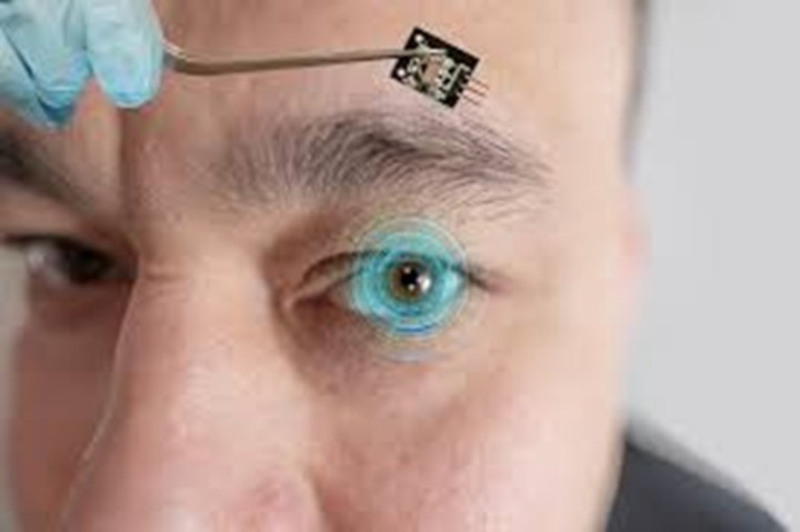 Microchip devolve visão a cegos com doença na retina. Tecnologia tem 84% de êxito.