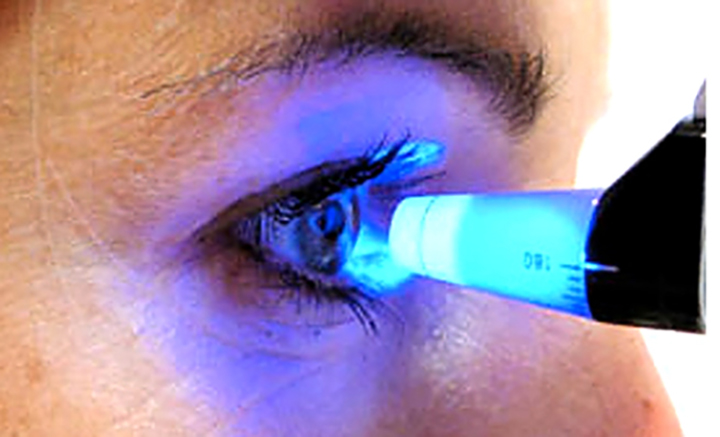 Novas tecnologias ajudam prevenir a cegueira pelo glaucoma