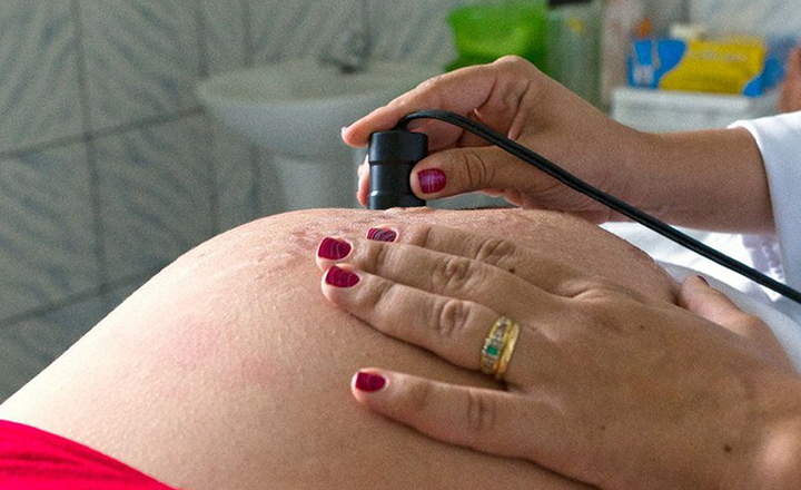 Mulher brasileira pode fazer laqueadura aos 21 anos
